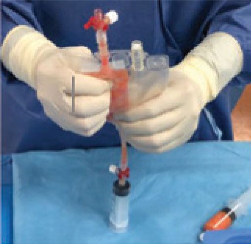 Why low molecular weight HA in wound healing? 