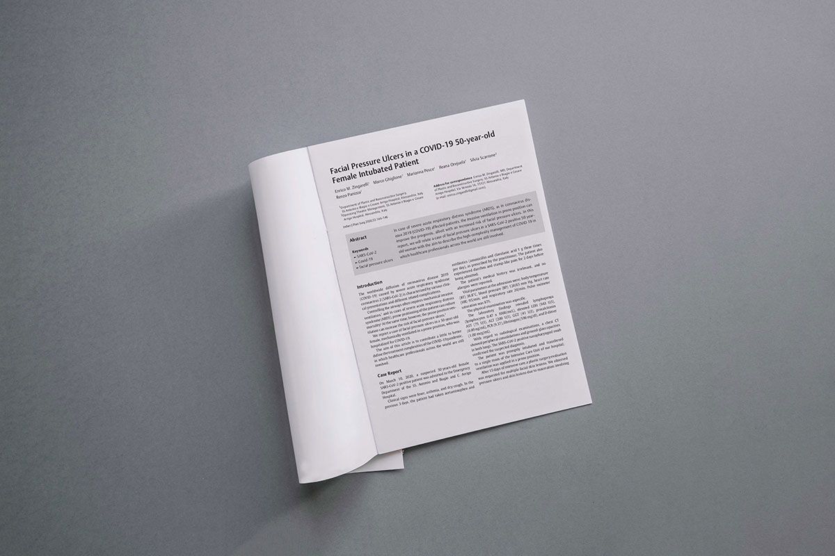 Recent publication about "ha-based products in Covid-19 patient"